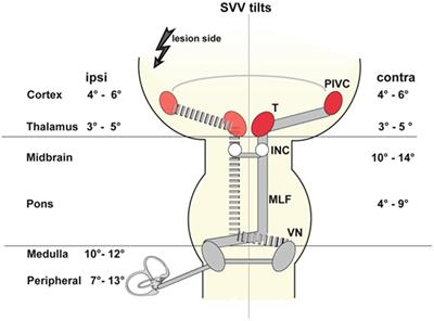 Perception of Verticality and Vestibular Disorders of Balance and Falls